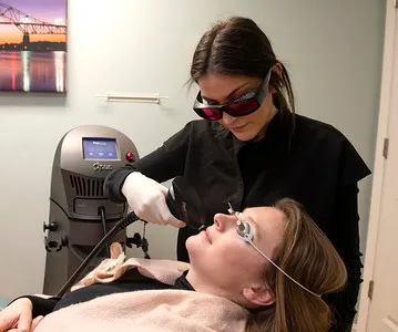 Opus RF skin renewal treatment being performed in the office